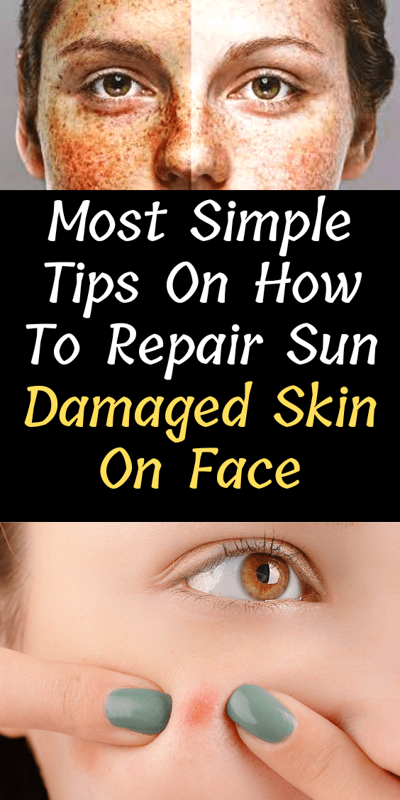 most-simple-tips-on-how-to-repair-sun-damaged-skin-on-face-she-made